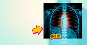 A broken rib x-ray and an illustrated pain concept with arrows in vibrant contrasting colors
